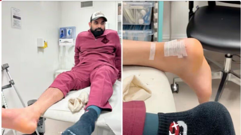 IPL 2024 : आईपीएल से पहले शमी ने चोट को लेकर दी बड़ी अपडेट...!  सर्जरी के बाद पहली बार दिखाई एड़ी